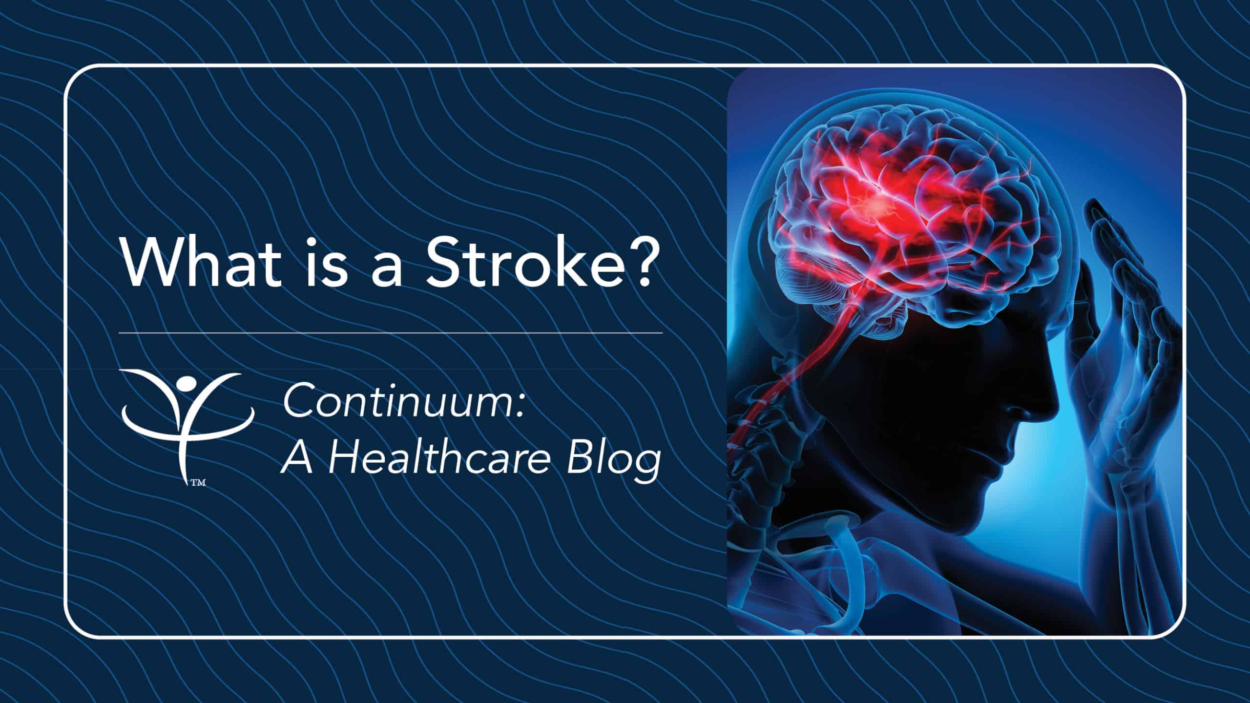 What is a Stroke? | Vibra Healthcare